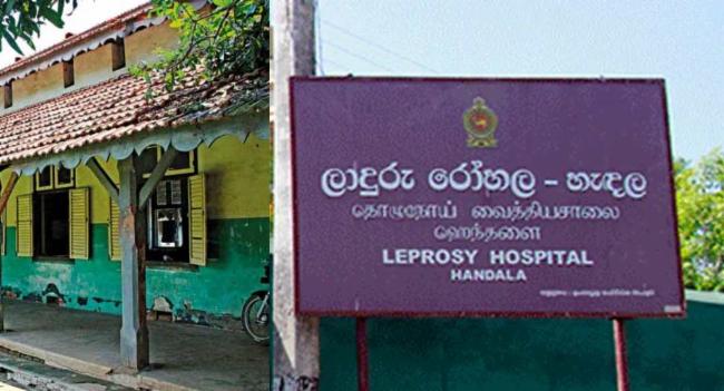 Sri Lanka observes spike in Leprosy cases